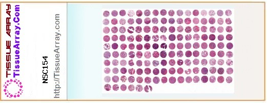 TissueArray.Com Tissue Array NSC154