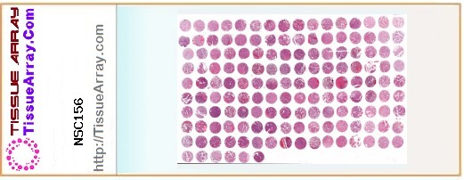 TissueArray.Com Tissue Array NSC156