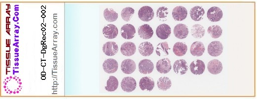 TissueArray.Com Tissue Array OD-CT-DgRec02-002