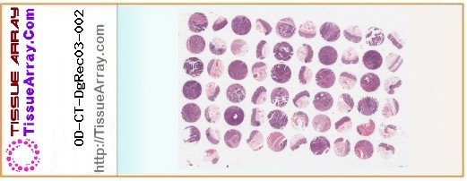 TissueArray.Com Tissue Array OD-CT-DgRec03-002