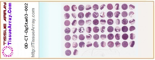 TissueArray.Com Tissue Array OD-CT-DgStm03-002