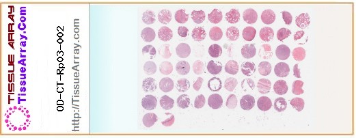 TissueArray.Com Tissue Array OD-CT-Rp03-002