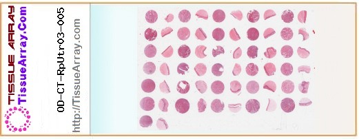 TissueArray.Com Tissue Array OD-CT-RpUtr03-005