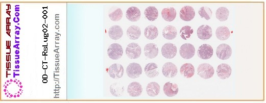 TissueArray.Com Tissue Array OD-CT-RsLug02-001