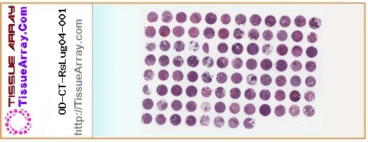 TissueArray.Com Tissue Array OD-CT-RsLug04-001