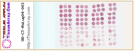 TissueArray.Com Tissue Array OD-CT-RsLug04-003