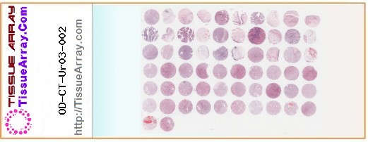 TissueArray.Com Tissue Array OD-CT-Ur03-002