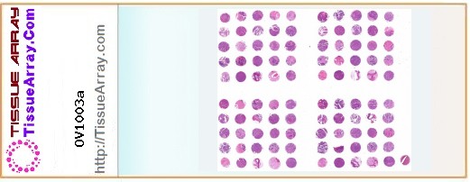 TissueArray.Com Tissue Array OV1003a