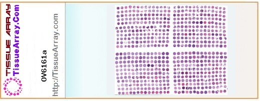 TissueArray.Com Tissue Array OV6161a