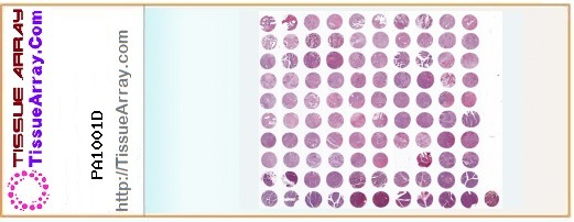 TissueArray.Com Tissue Array PA1001D