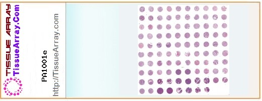 TissueArray.Com Tissue Array PA1001e