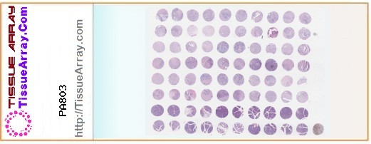 TissueArray.Com Tissue Array PA803