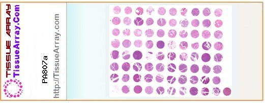 TissueArray.Com Tissue Array PA807a