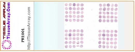 TissueArray.Com Tissue Array PR1001