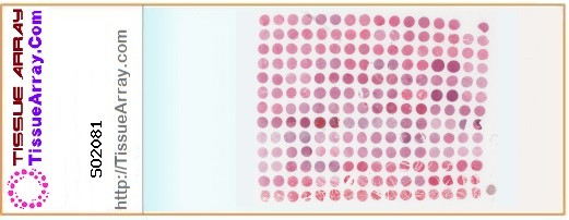 TissueArray.Com Tissue Array SO2081