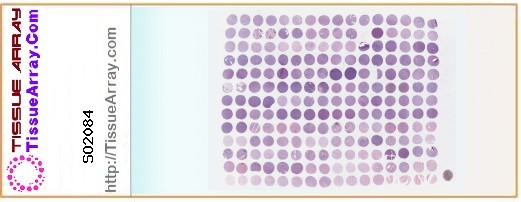 TissueArray.Com Tissue Array SO2084