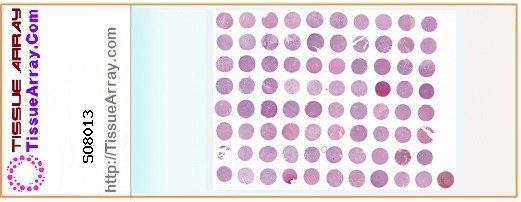 TissueArray.Com Tissue Array SO8013