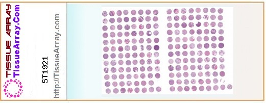 TissueArray.Com Tissue Array ST1921