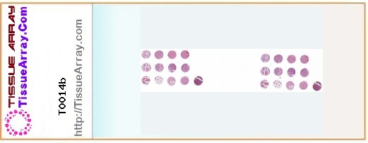 TissueArray.Com Tissue Array T0014b