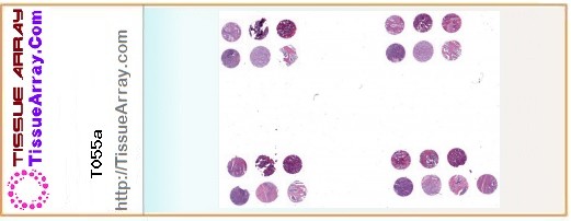 TissueArray.Com Tissue Array T055a