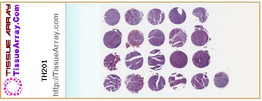 TissueArray.Com Tissue Array TH201