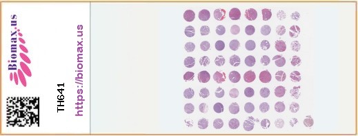 TissueArray.Com Tissue Array TH641