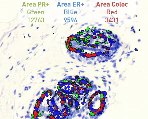 TissueArray.Com Colocalization of nuclear stains