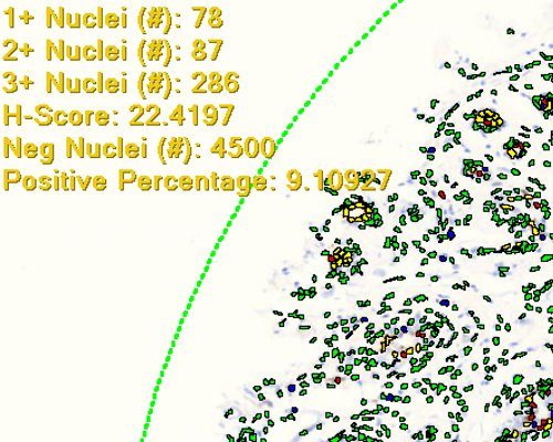 tissuearray.com PR nuclear analysis